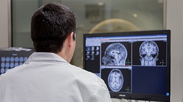 Demostren un major consum de glucosa cerebral en les primeres etapes de l'Alzheimer associat a l’activació dels astròcits