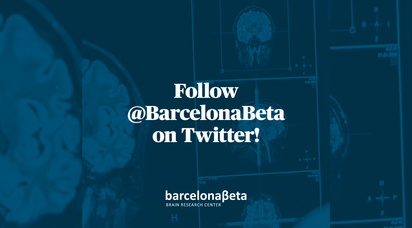 El Barcelonaβeta Brain Research Center (BBRC) estrena perfil de Twitter